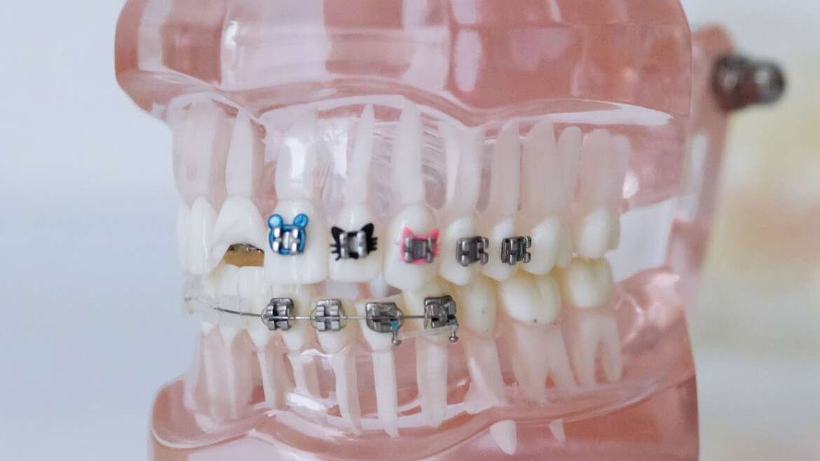 Children’s Dental Care in Birmingham: A Parent’s Guide to Healthy Teeth