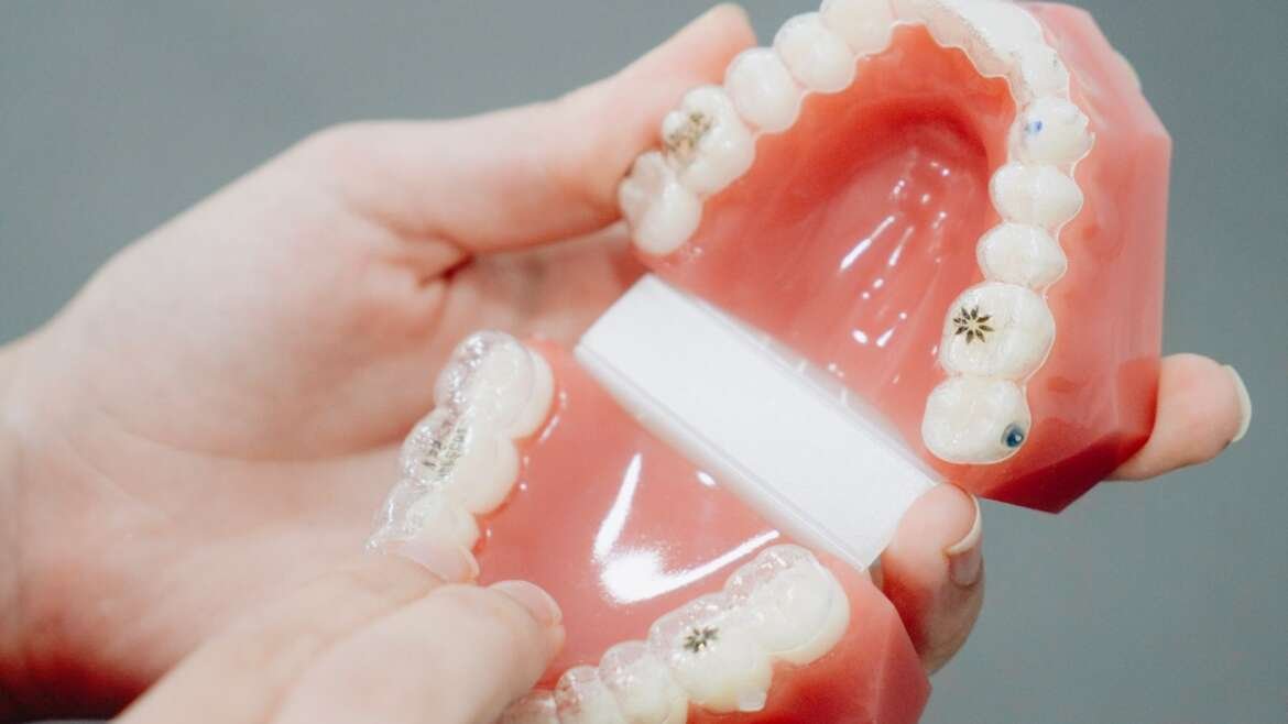 Invisalign vs Fixed Braces in Birmingham: How to Choose the Right Orthodontic Treatment