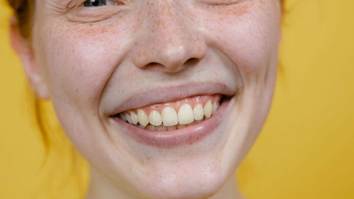Smile Makeover in Birmingham: How Cosmetic Treatments Are Combined for Natural Results