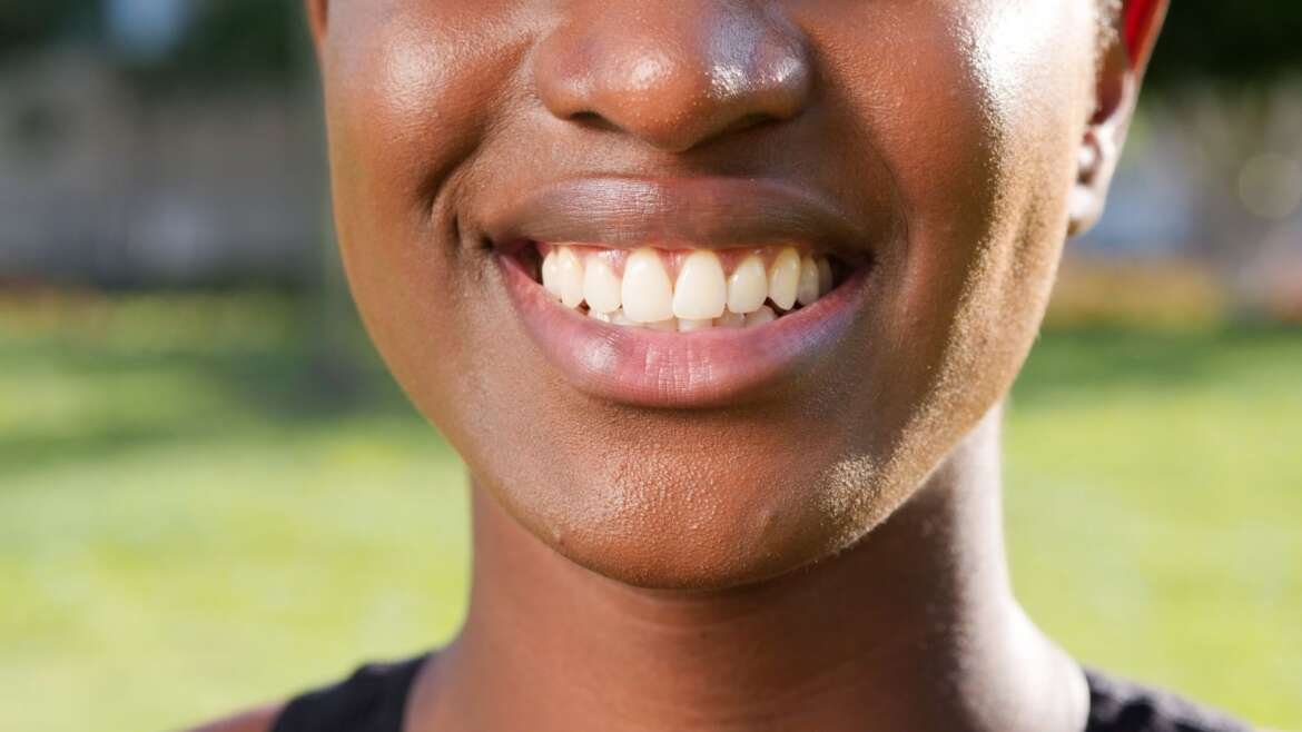 Tooth Extraction Aftercare: How to Heal Well and Avoid Dry Socket